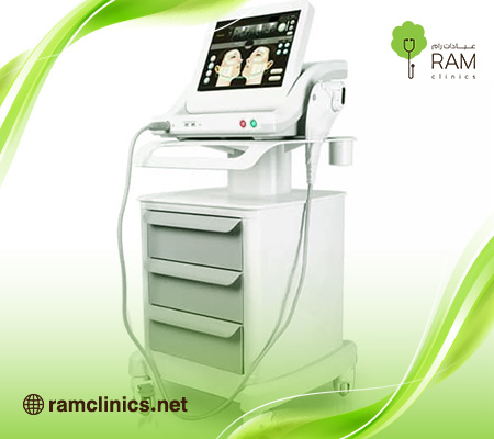 ما-هو-الهايفو