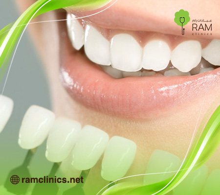 اسعار-تركيبات-الزيركون