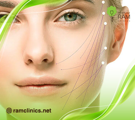 ابرة-اندولفت