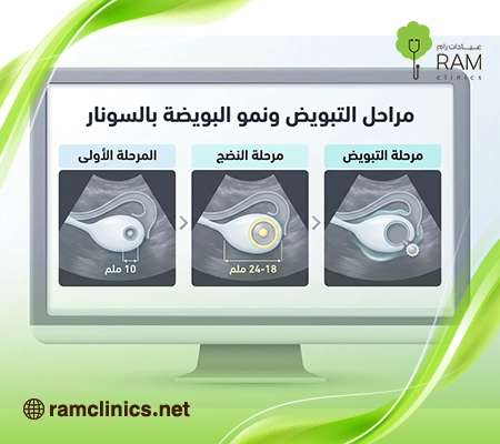 صورة-توضح-برنامج-متابعة-التبويض صورة-توضح-برنامج-متابعة-التبويض