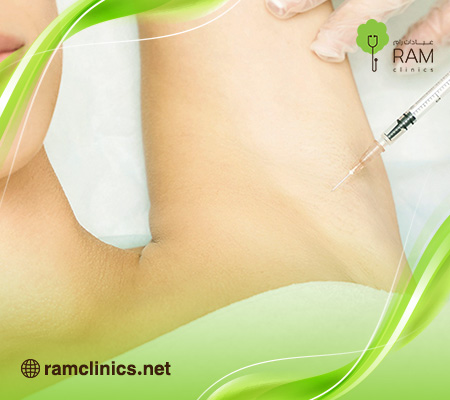 بوتكس-تعرق بوتكس-تعرق