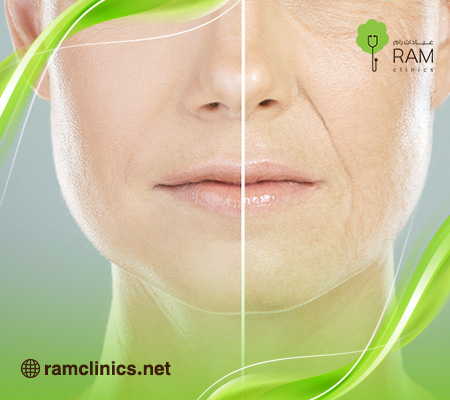 ماهو-اندولفت-للوجه